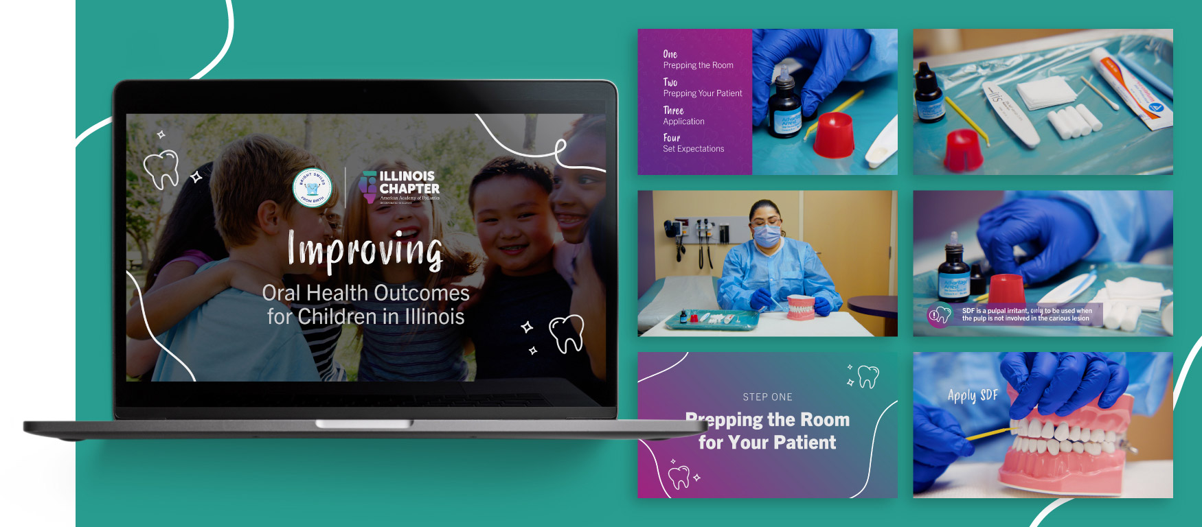 ICAAP Oral Health Outcomes Video on Laptop Display